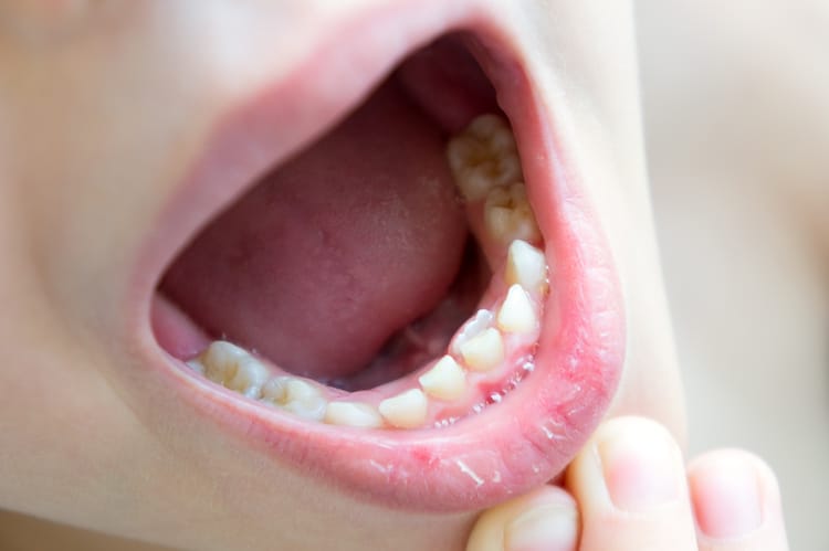 shark teeth