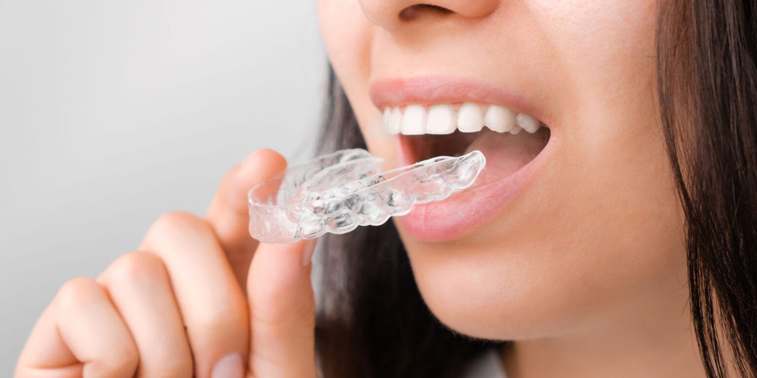 Orthodontic Retention Guide | Families First Pediatrics | Orthodontics