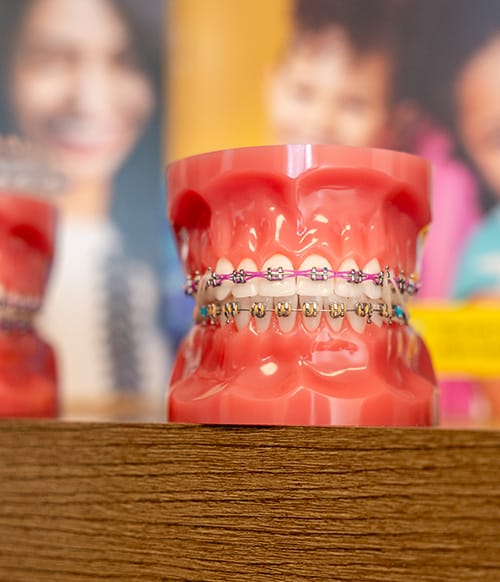 Model teeth on a shelf in the Bluffdale, UT office