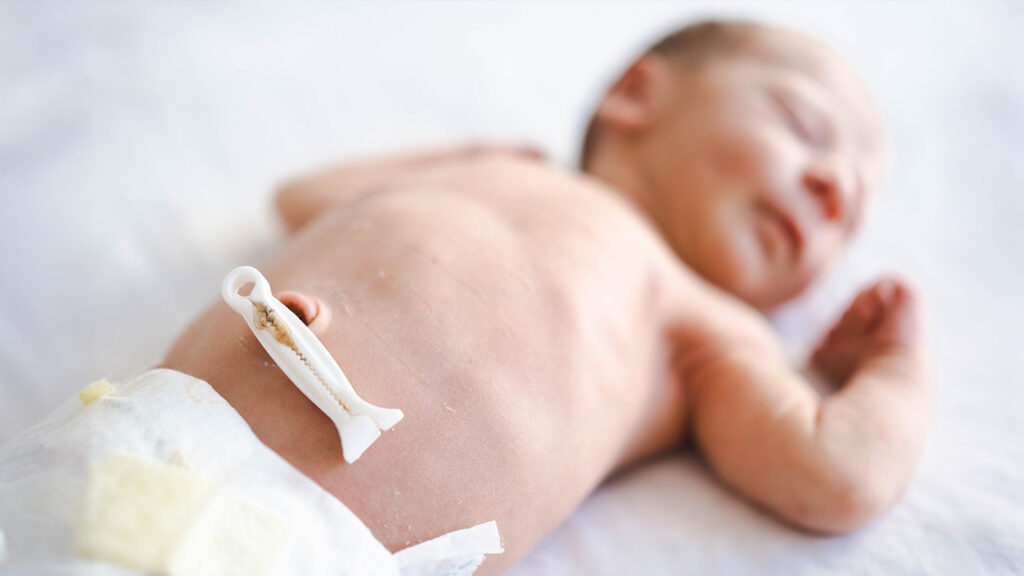 Newborn baby with a fresh umbilical cord stump