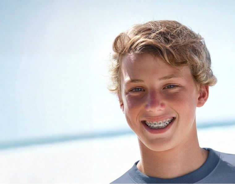 young boy smiling with braces on spring break