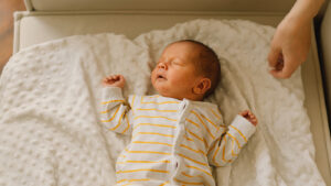 newborn baby with jaundice