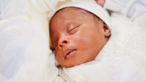 Newborn baby with jaundice